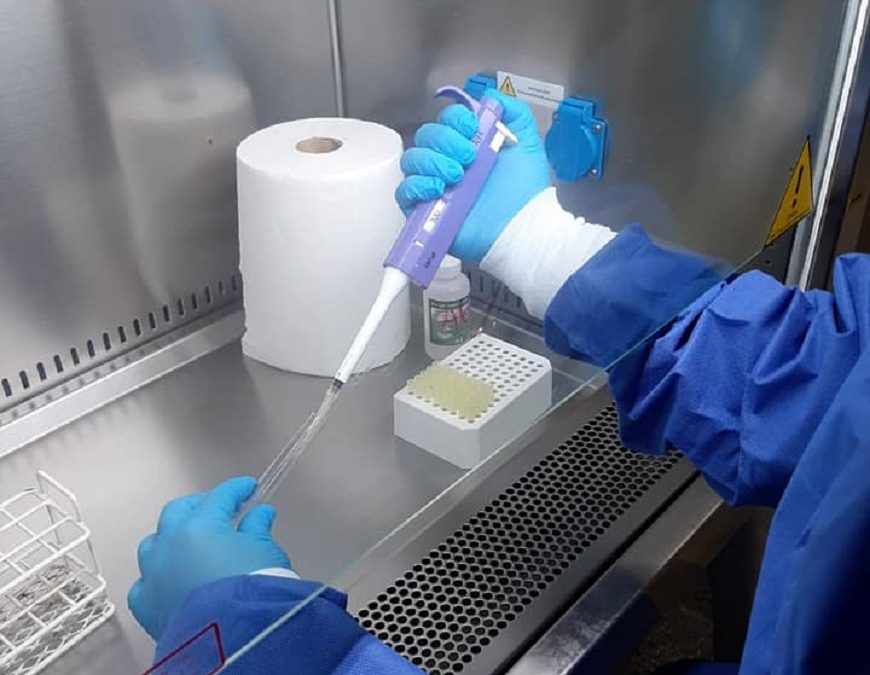 Salud entregó equipos a hospitales de Lambaré, Yby Yau y Misiones