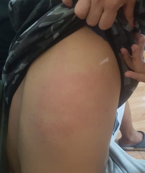 Denuncian violento procedimiento policial con adolescentes