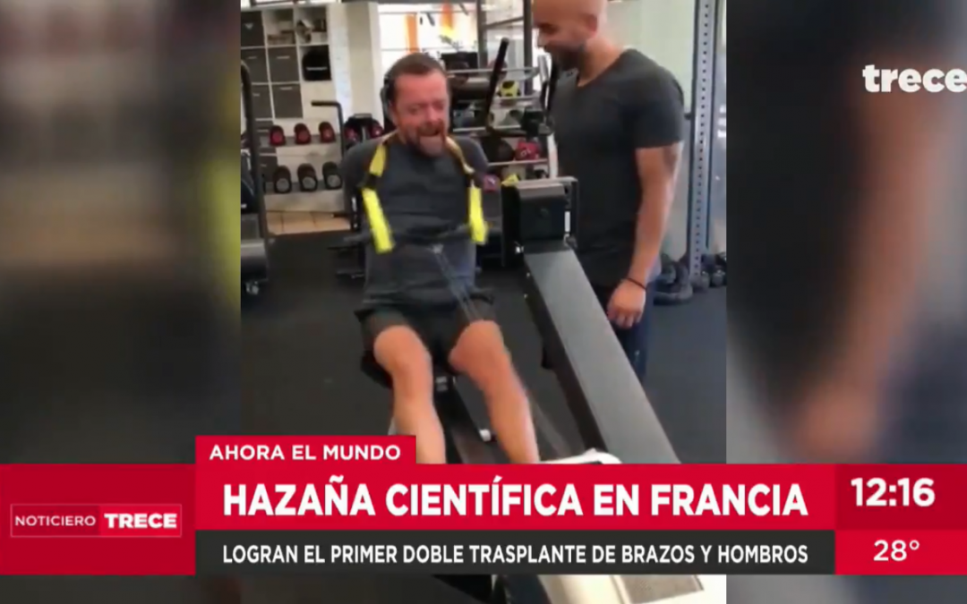 Paciente islandés recibió doble trasplante de brazos en Francia