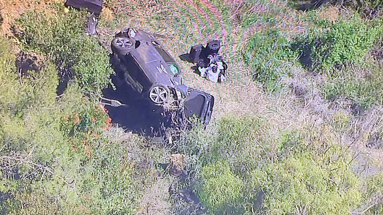 Tiger Woods, hospitalizado tras grave accidente