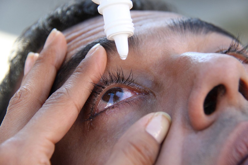 Conjuntivitis: ¿Cómo evitar el contagio?