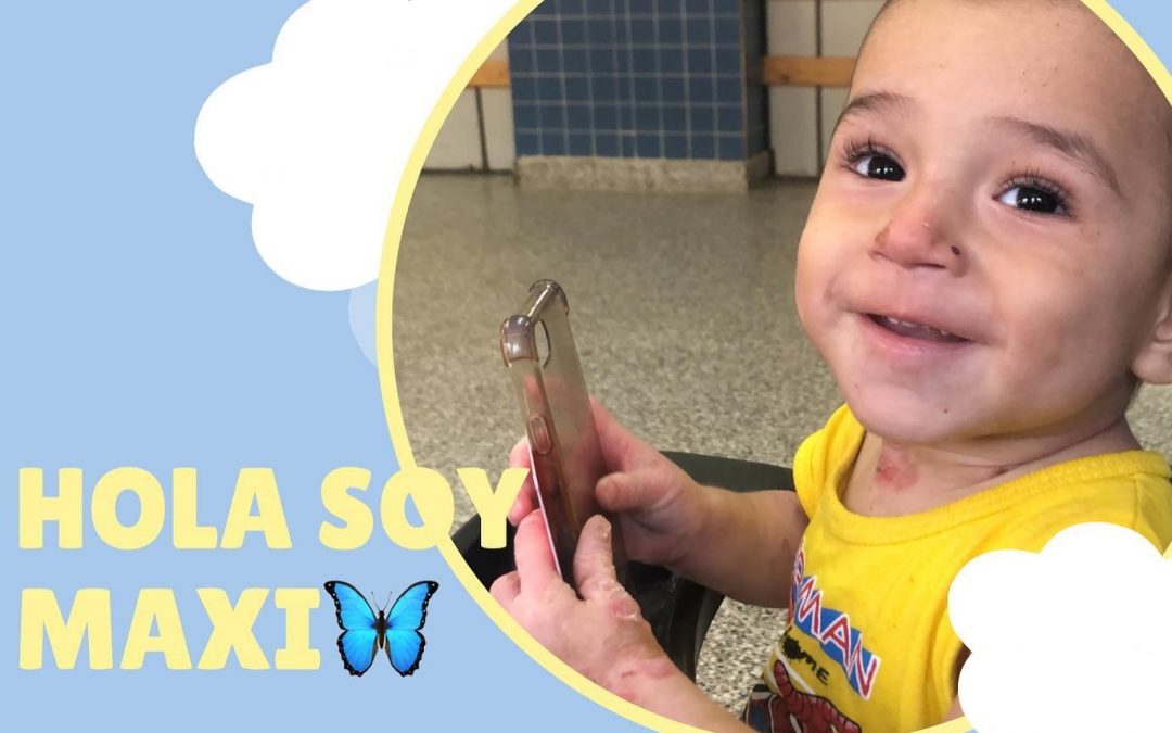 Maxi, el bebé con “piel de cristal” que necesita viajar a España para su tratamiento