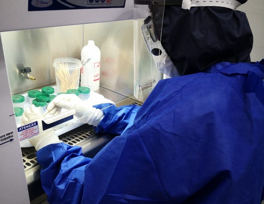 Salud: Paraguay cuenta con primer caso sospechoso de viruela del mono