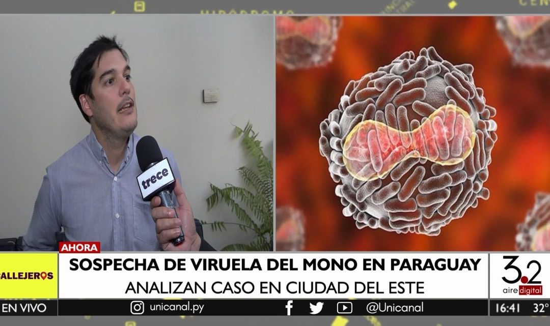 Viruela de mono: analizan caso sospechoso en CDE
