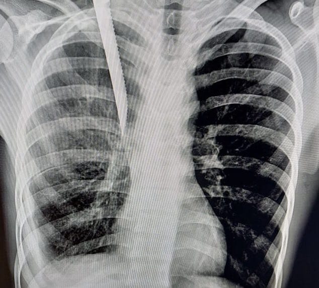 J. Augusto Saldívar: Joven fue apuñalado en plena calle por supuesto paciente psiquiátrico