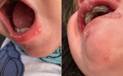 No dejes que nadie bese a tu bebé, aunque se enojen, aconseja pediatra