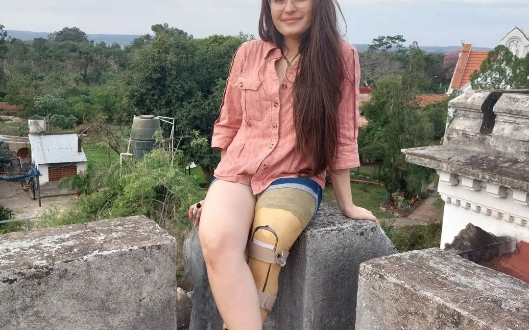 ¡Todos por Lari!: joven pide ayuda para costear prótesis que mejore su calidad de vida  