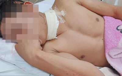 Motociclista casi muere degollado por un alambre colocado en medio de la calle