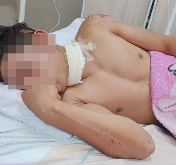 Motociclista casi muere degollado por un alambre colocado en medio de la calle