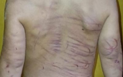 Hombre habría propinado brutal golpiza a su pareja e hijastro de 3 años