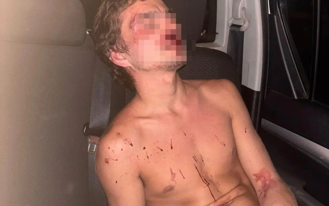 Brutal golpiza a conductor de plataforma: “Si no me opero, puedo perder la vista”