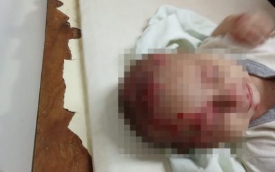 Actualizan el estado de salud de los niños rescatados en Itauguá