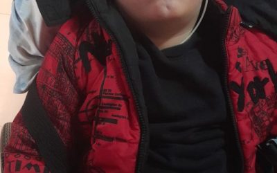 Nico nos necesita: tiene parálisis cerebral y debe someterse a una cirugía