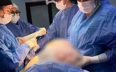 Tumor de 11 kilos es extirpado a una mujer de 56 años en PJC