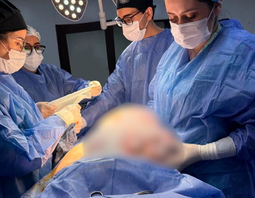 Tumor de 11 kilos es extirpado a una mujer de 56 años en PJC