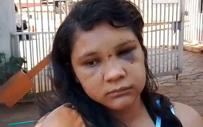 Mujer denuncia a su expareja por agresión y amenaza de muerte