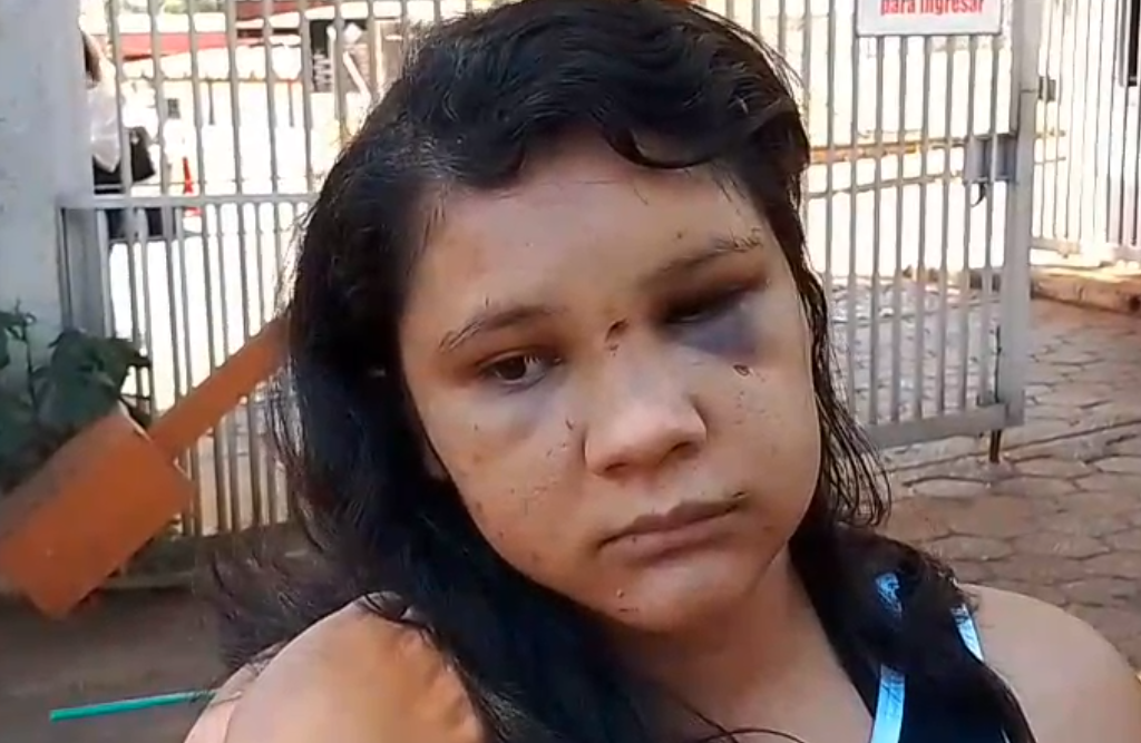 Mujer denuncia a su expareja por agresión y amenaza de muerte