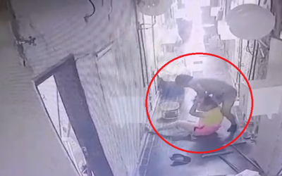 MRA: trabajadora de motel fue agredida brutalmente por un cliente