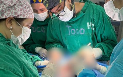 Clínicas realiza compleja cirugía de extirpación tumoral a recién nacida