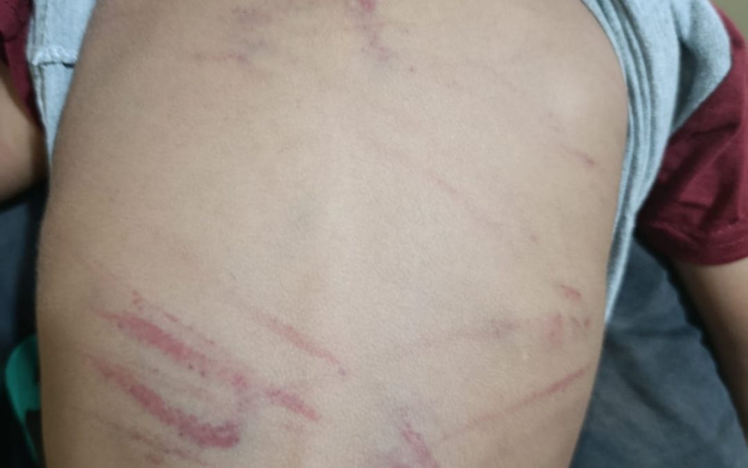 Detienen a madrastra por presunto maltrato a niño de 3 años