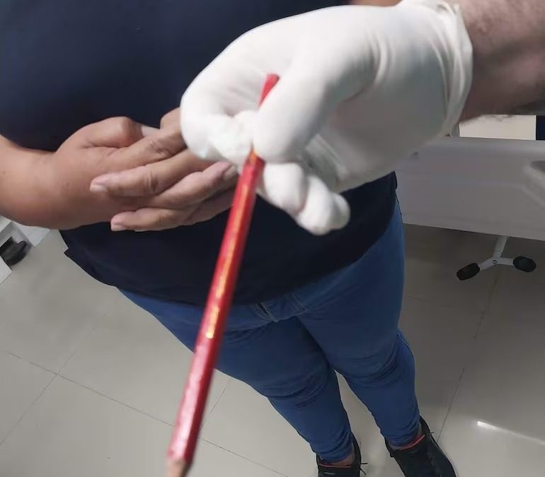 Piden ayuda para niño que sufrió perforación intestinal tras “broma” de compañeros