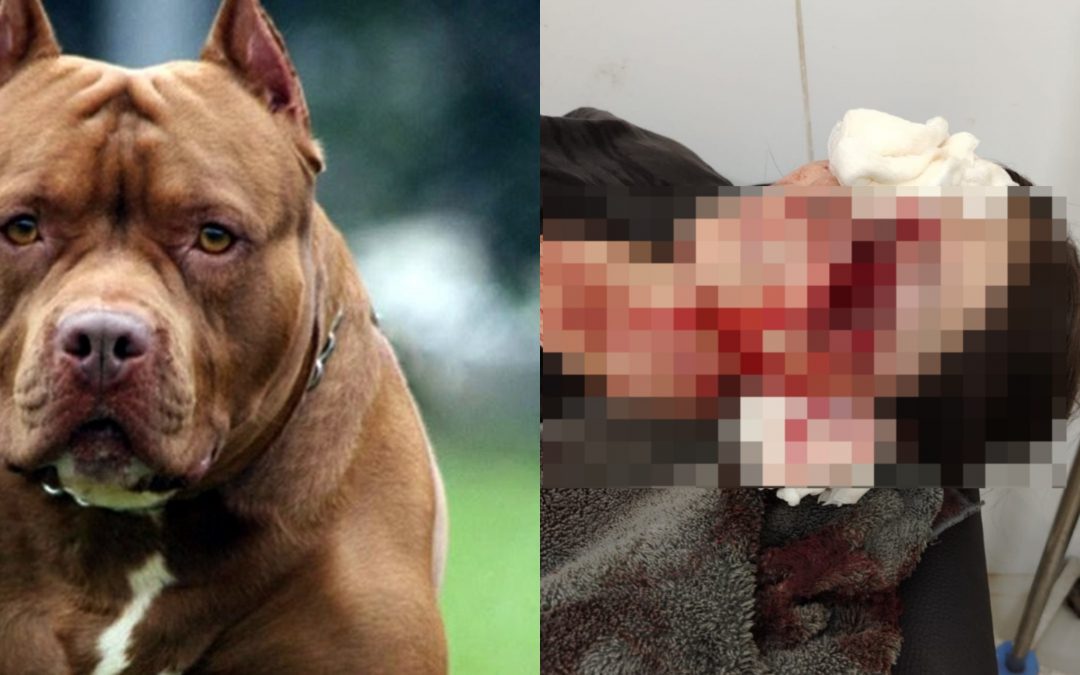Pitbull atacó a su propia dueña y la dejó con el rostro desfigurado