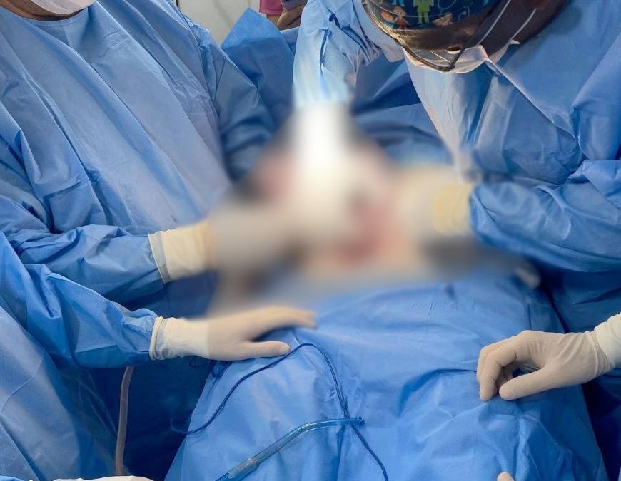Extraen mioma de gran tamaño a paciente de 42 años en Villa Elisa